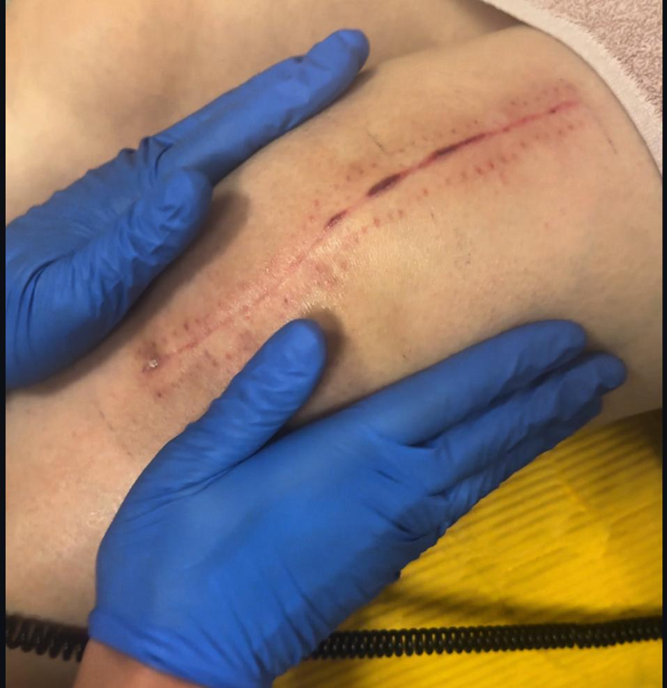 Deep Oscillation Therapy
